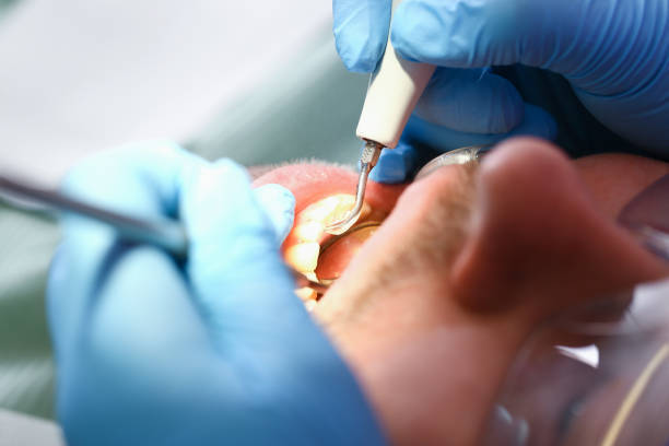 Best Emergency Tooth Extraction  in Rutland, VT